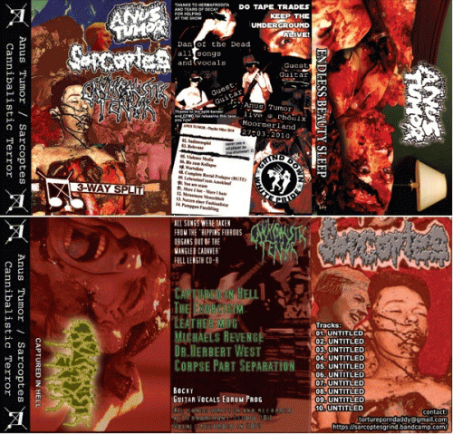 Sarcoptes (USA-1) : 3 Way Split